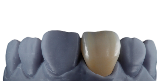 Incisal Premium