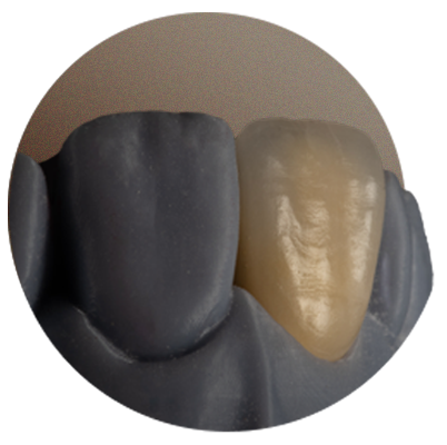 Diente Incisal